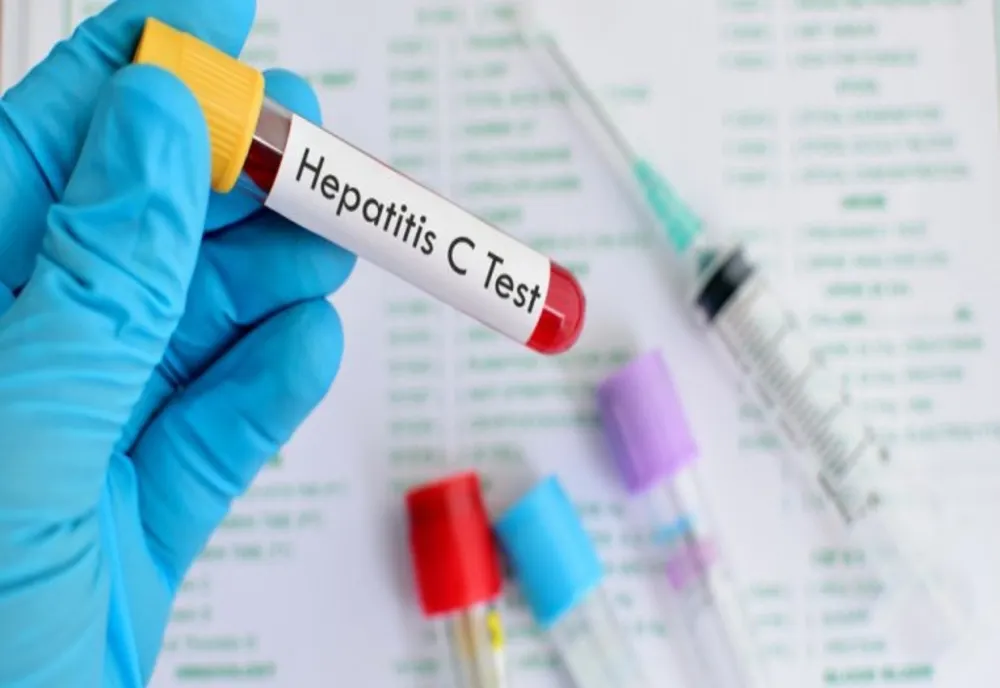 Giurgiu, în topul județelor cu cele mai multe persoane infectate cu virusul hepatic C