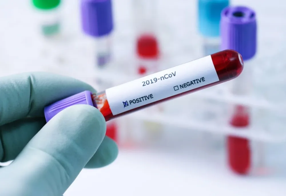 Record în România: 8.651 NOI CAZURI de INFECTARE cu COVID-19. Situația infectărilor din fiecare județ