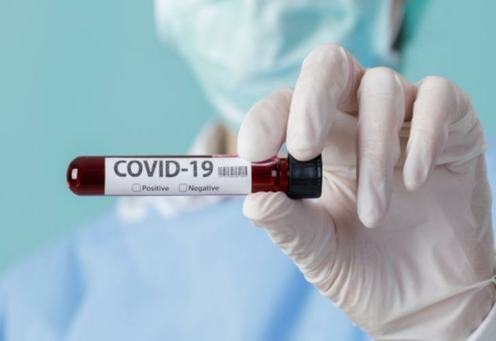 COVID -19. 2.121 de noi cazuri, în țară. În ce județe sunt cei mai mulți infectați