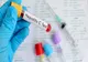 Giurgiu, în topul județelor cu cele mai multe persoane infectate cu virusul hepatic C