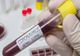 Creşte numărul giurgiuvenilor infectaţi cu COVID 19. Bilanţul a ajuns la 91