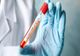 Doi giurgiuveni infectaţi cu COVID 19 au decedat 