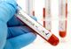 Încă un giurgiuvean infectat cu coronavirus. Numărul cazurilor a ajuns la 212