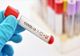 Elev de liceu din Giurgiu, diagnosticat cu noul coronavirus